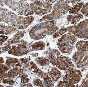 GPNMB Antibody