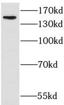 ADGRF5 Antibody
