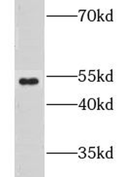 GPR142 Rabbit Polyclonal Antibody