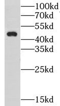 GPR22 Rabbit Polyclonal Antibody