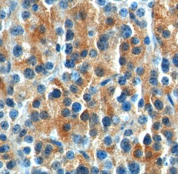 HCAR1 Rabbit Polyclonal Antibody