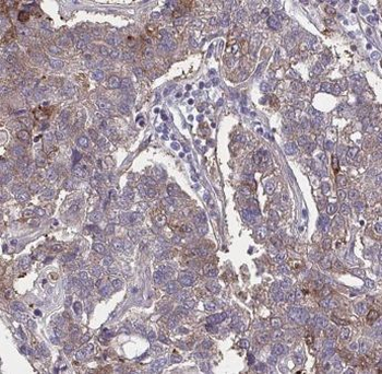 GPSM2 Antibody