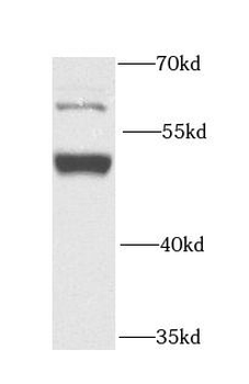 GPT Rabbit Polyclonal Antibody