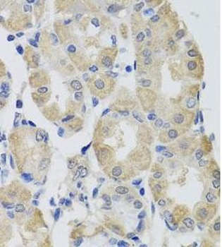 GPT Rabbit Polyclonal Antibody