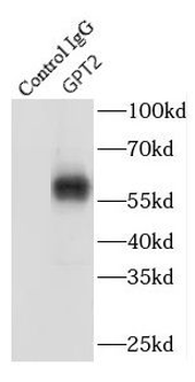 GPT2 Antibody