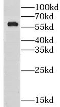 GPT2 Antibody