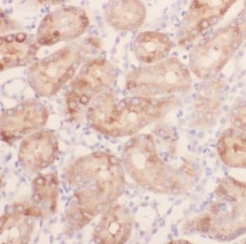 GPT2 Antibody