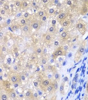 GPX4 Antibody