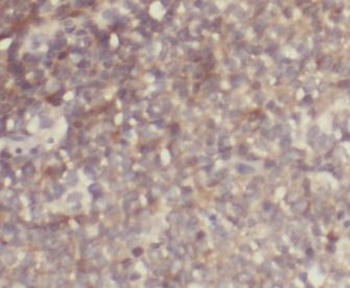 GRAP Antibody