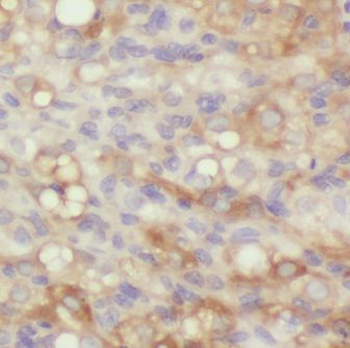 GRB14 Antibody