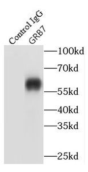 GRB7 Antibody