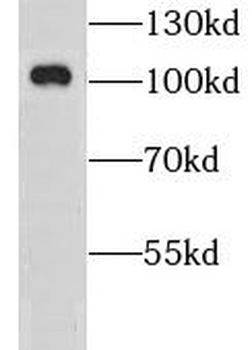 GRIA4 Antibody