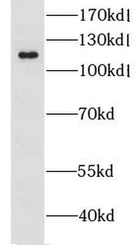 GRIK2 Rabbit Polyclonal Antibody