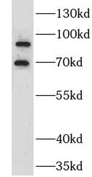 GRK3 Rabbit Polyclonal Antibody