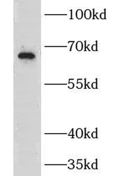 GRK6 Antibody