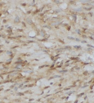 GOSR1 Antibody