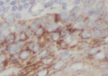 GSDMD Antibody