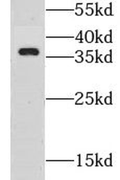 GSG1L Antibody