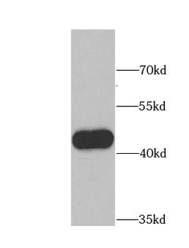 GSK3B Rabbit Polyclonal Antibody