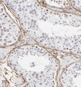 GSK3B Rabbit Polyclonal Antibody