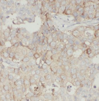 GSPT1 Antibody