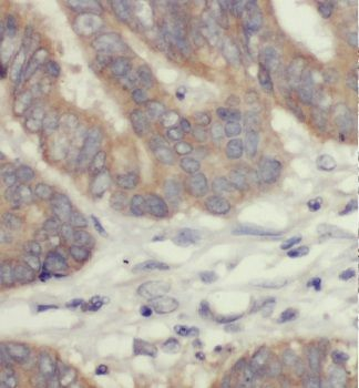 GSPT2 Antibody