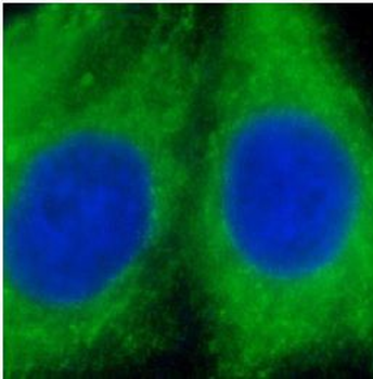 GSTA1 Antibody