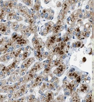 GSTA1 Antibody