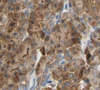 GSTA2 Antibody