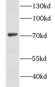 GSTCD Antibody
