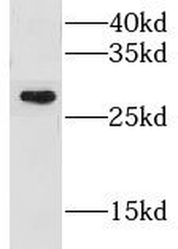 GSTM1 Rabbit Polyclonal Antibody