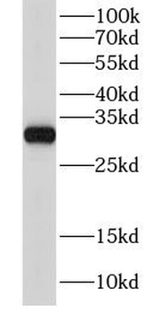 GSTM3 Antibody