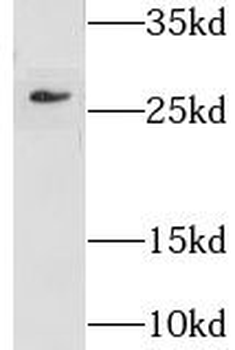 GSTM5 Antibody