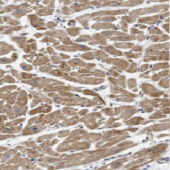 GSTM5 Antibody