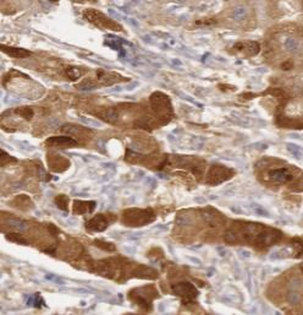 GSTO1 Antibody