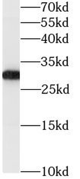 GSTO1 Antibody