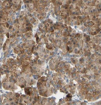 GSTO1 Antibody