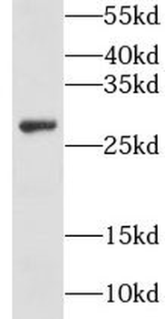 GSTO2 Rabbit Polyclonal Antibody