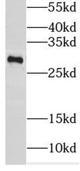 GSTT2 Antibody