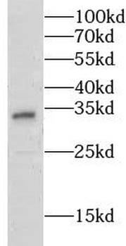 GSTZ1 Antibody