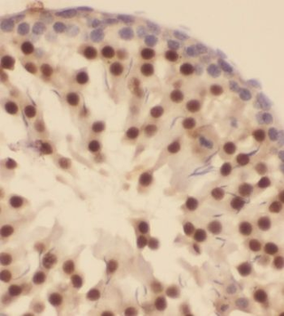 GTF2A1 Antibody