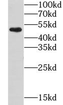 GTF2E1 Rabbit Polyclonal Antibody