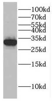 GTF2H3 Antibody
