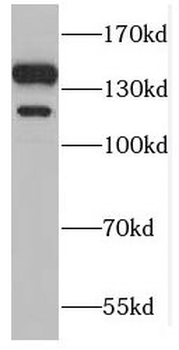 GTF2IRD1 Antibody