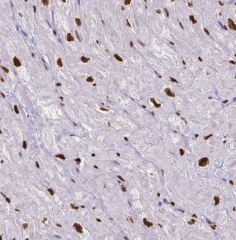 GTF2IRD1 Antibody