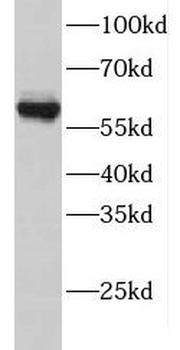 GTPBP2 Rabbit Polyclonal Antibody