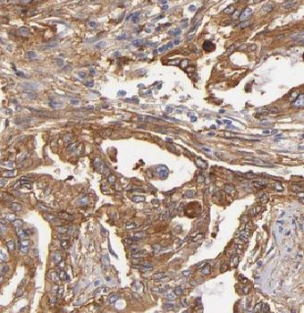 GTPBP2 Rabbit Polyclonal Antibody