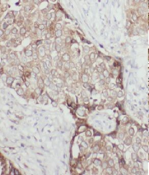 GTPBP3 Antibody