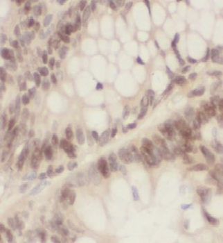OLA1 Antibody