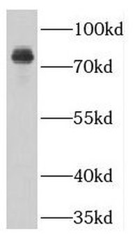 GUCY1A1 Antibody